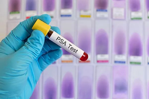 Prostate Profile (3 health indicators)- In Store/Home