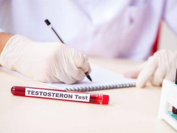 Testosterone Check 1 health indicators-in store/ home