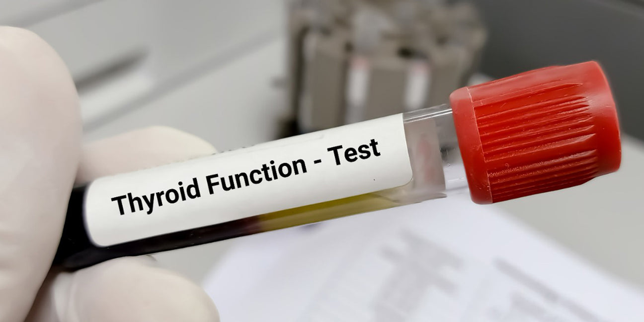 Thyroid Function Test （In store/ Home）