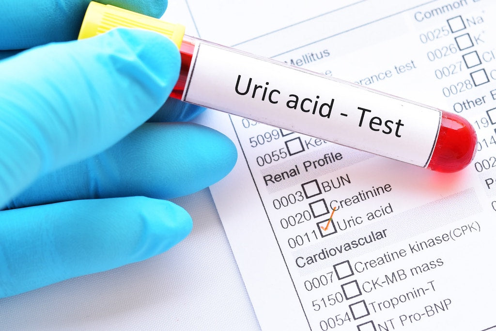 Uric acid Test (In Store)